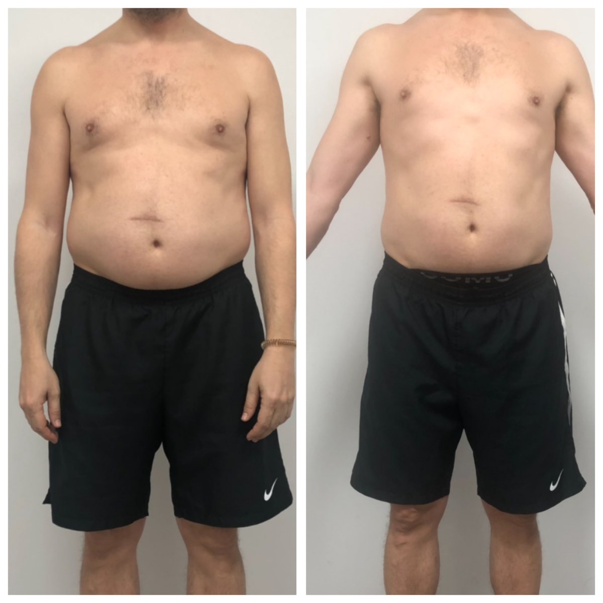 Client before and after training with EMS